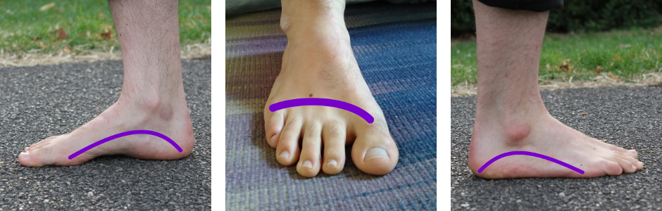 three arch support toes